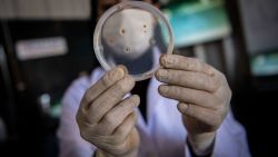 Doctor explica el posible origen de las infecciones de bacterias que dejaron 17 muertes en México